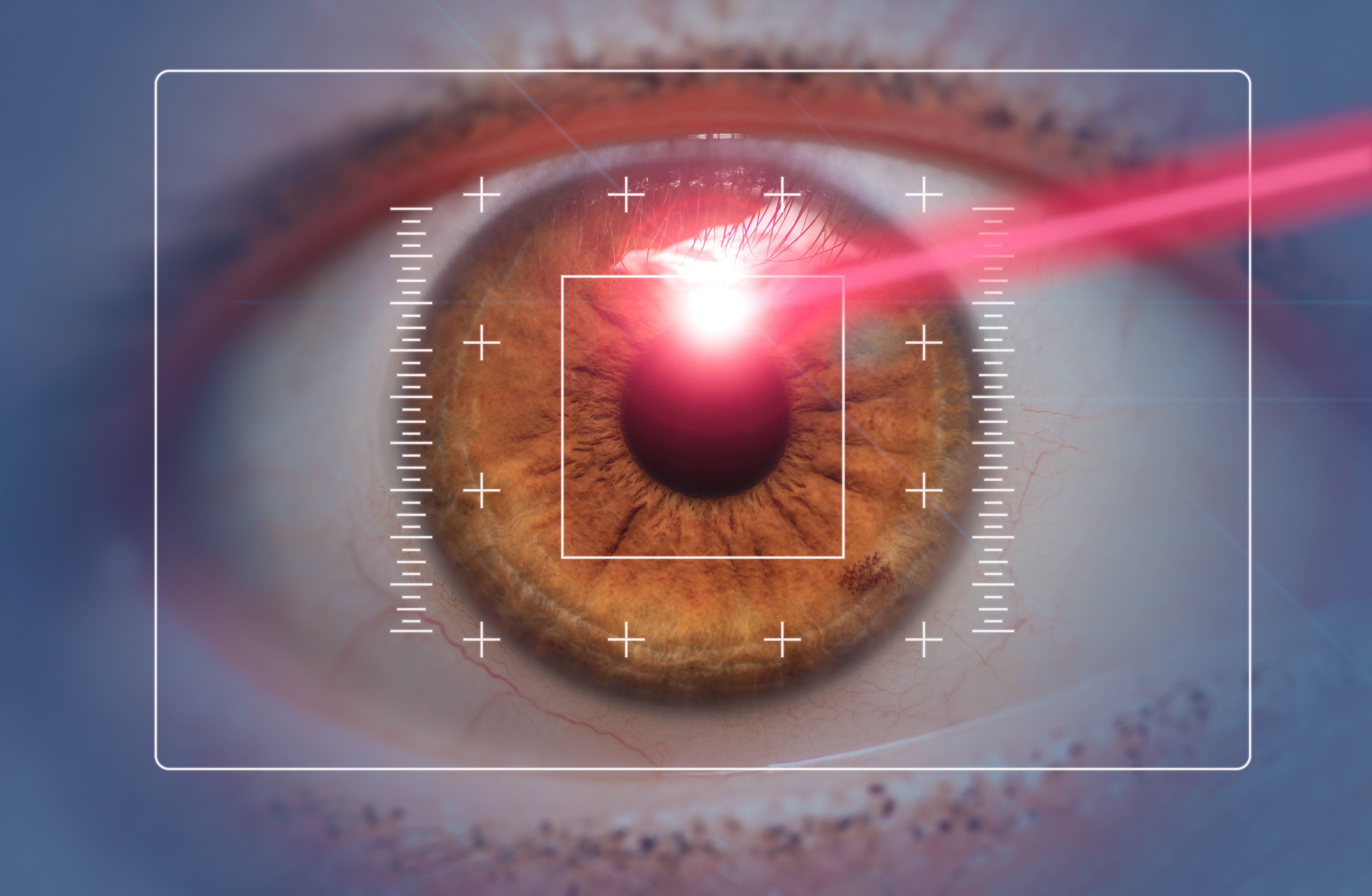 台中眼睛雷射專家視保眼科引進近視微創 i LASIK雷射手術 |